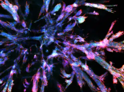 pancreatic cancer organoid