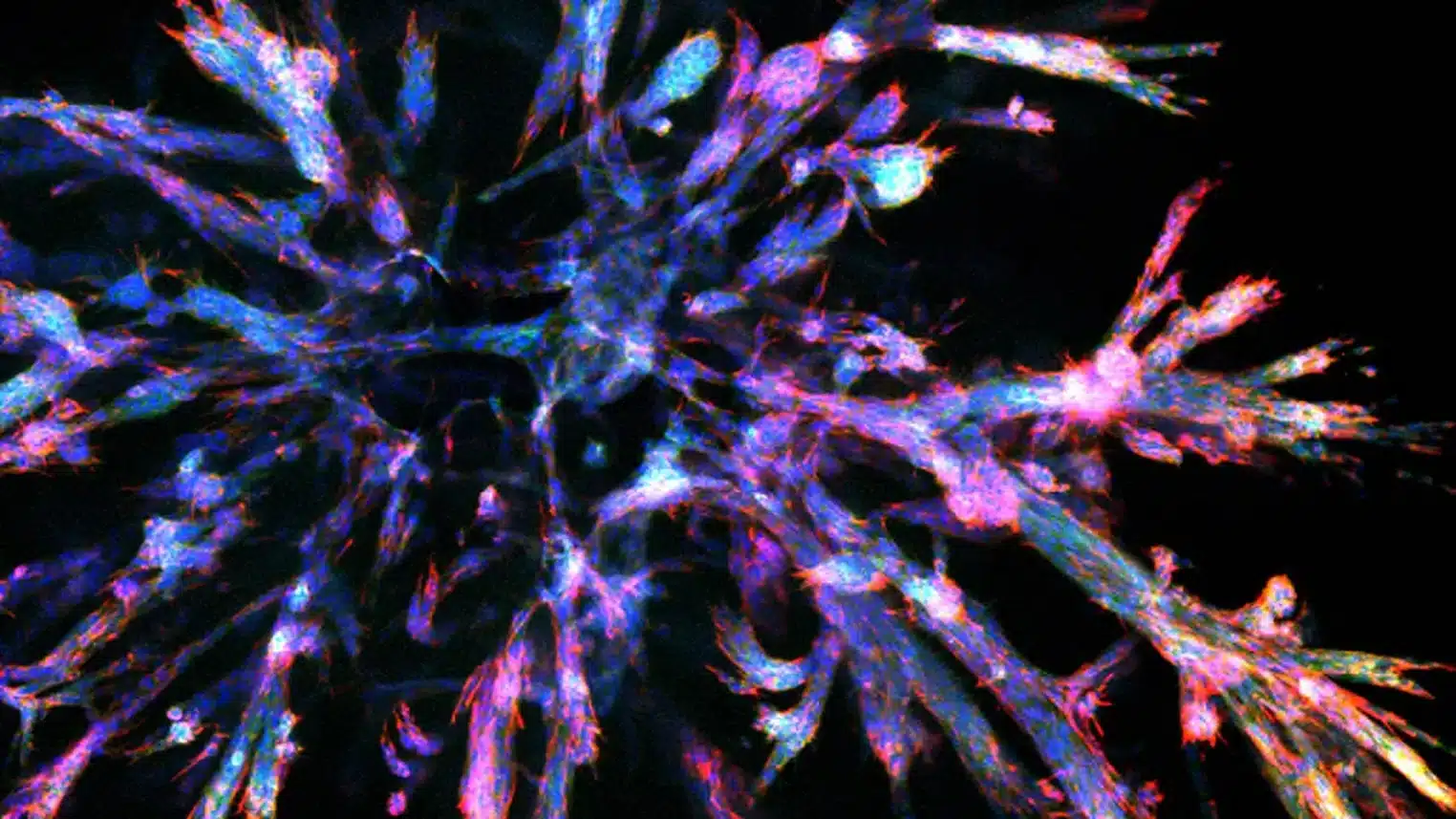 pancreatic cancer organoid